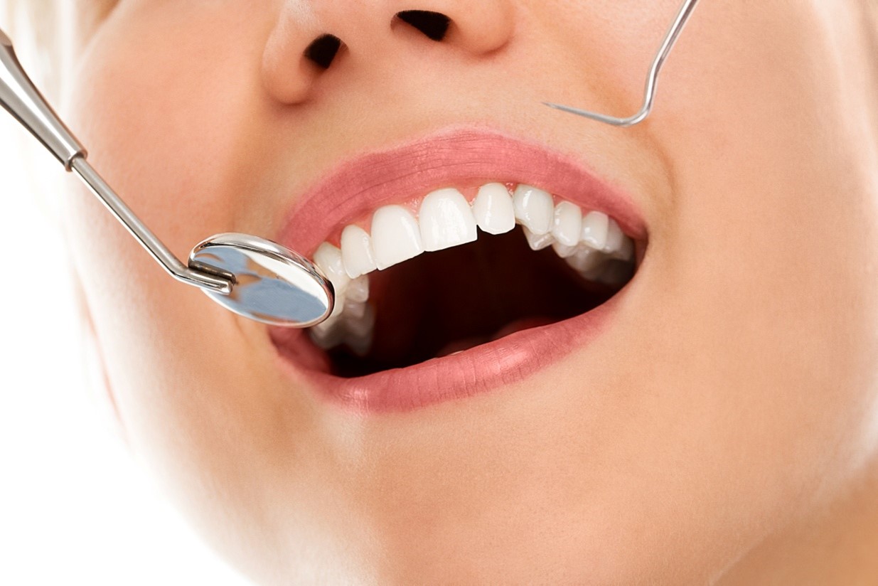 5 Preventive Measures to Avoid Hypodontia & Maintain Good Oral Health