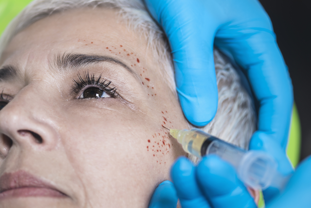 Unlocking The Secrets Of PRP Facial Treatments: What You Need To Know